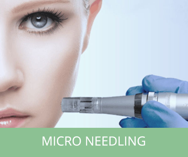 Afbeelding van micro needling therapie met de dermapen bij Esthetiek Huidtherapie in Nijmegen.