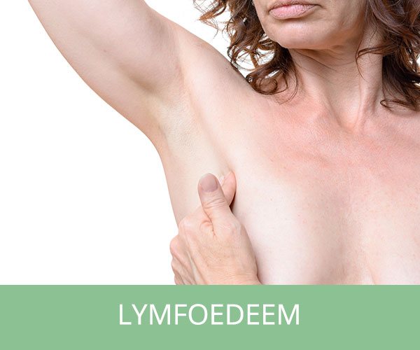 Vrouw met lymfoedeem onder de oksel.